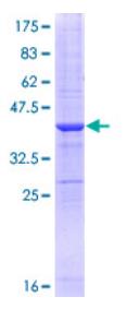SDS-PAGE (MRC2-5535H).jpg